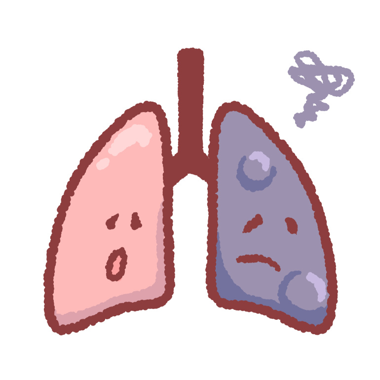 肺気腫３
